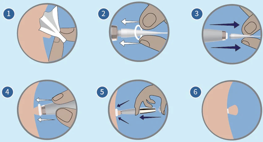 Rapid Tag Removal Kit